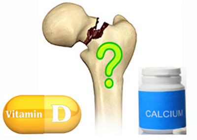 Complete-displace-Hip-Joint-fracture
