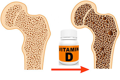 VitD-bone